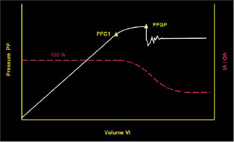 Figure 2: There should be a linear trend for pump pressure (PP) and volume of mud pumped in (VI) until PP reaches PFG1. Continued pumping past this point would result in a pressure that causes fracture propagation (PFGP). Large losses may resume.